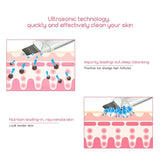 Luxur™ Ultrasonic Skin Scrubber